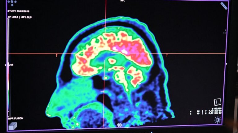 What We Know About ADHD : 1A : NPR